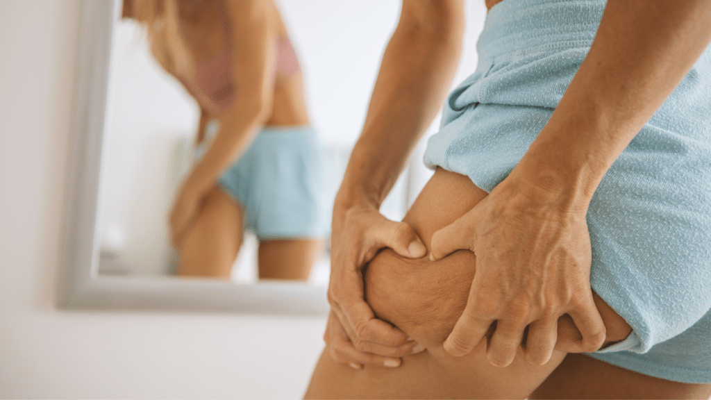 retention d'eau et cellulite