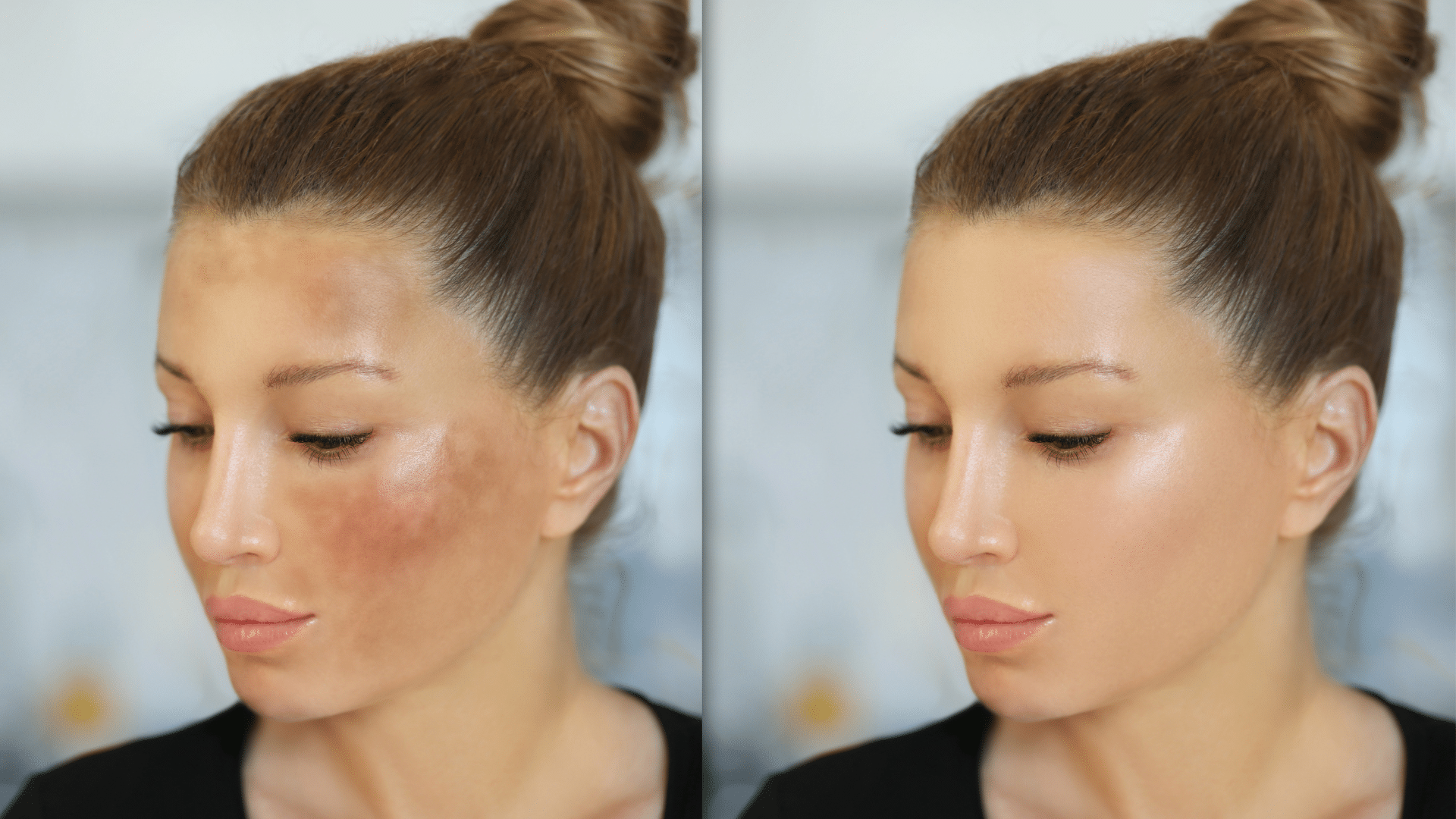 Tâches pigmentaires, soins réparateurs Bruxelles