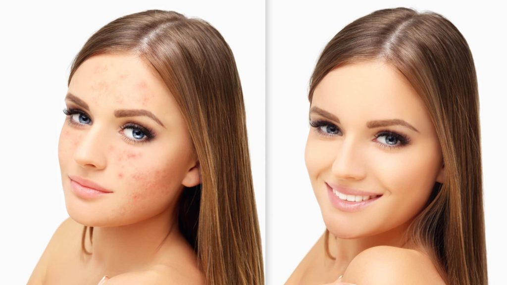 soins réparateurs soins réparateurs bruxelles repulper le visage revitaliser le visage revitaliser la peau vitalité peau