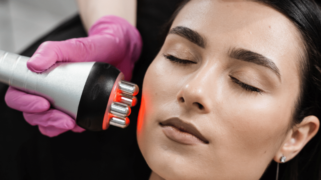 radiofréquence visage