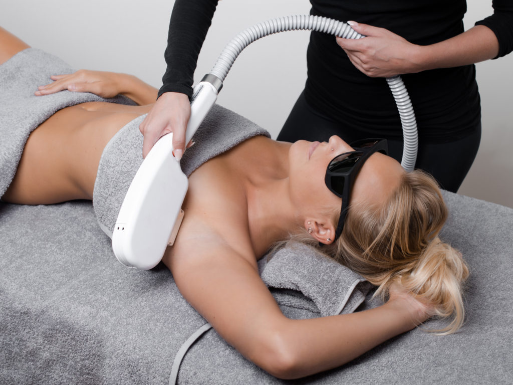 Épilation définitive