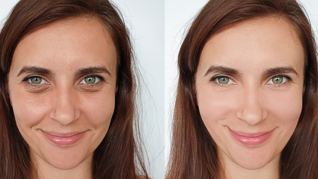 hydrafacial bruxelles