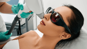 Epilation visage femme